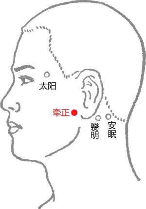 牽正穴|牽正穴